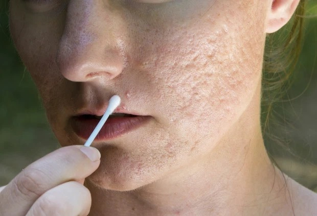 Một số nghiên cứu trong phòng thí nghiệm và thử nghiệm trên chuột phát hiện ra rằng một số chất lọc UV hữu cơ, trong đó có oxybenzone, paraben và phthalate, bị nghi là gây rối loạn nội tiết.