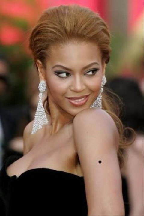 11. Cánh tay có nốt ruồi: Có khả năng kiếm tiền và năng lực quản lý tài chính vững mạnh.