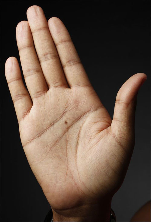 12. Lòng bàn tay có nốt ruồi: Phú quý, có năng lực quản lý.