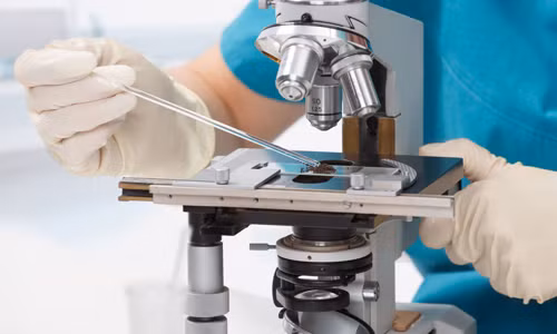 Vi khuan “sat thu” tu Viet Nam lay mang nguoi trong 24 gio