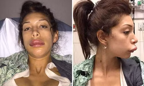 Nhung vu bom moi hong kinh hoang nhat the gioi-Hinh-3