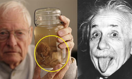 Khi còn sống, thiên tài vật lý Einstein bày tỏ nguyện vọng muốn được hỏa táng sau khi qua đời. Tuy nhiên, sau khi Einstein qua đời ở bệnh viện Princeton, bang New Jersey, Mỹ ngày 18/4/1955, nhà nghiên cứu bệnh học Thomas Harvey được cho là người đã đánh cắp bộ não của ông và đem thái lát nó. Hiện Bảo tàng Mutter ở Philadelphia, bang Pennsylvania là nơi duy nhất trên thế giới trưng bày các lát não của Einstein. bên trái ảnh là ông Harvey đang cầm lọ đựng mẫu não Einstein (bên phải ảnh) năm 1994.
