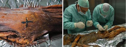 Xác ướp "Người đá Ötzi" - một trong những xác ướp được bảo quản tự nhiên nhất được các chuyên gia phát hiện có tới 57 hình xăm khác nhau trên các xác ướp, bao gồm dấu chấm, thánh giá nhỏ, và đường thẳng. Những hình xăm này được tìm thấy tương ứng với các khu vực thoái hóa và được cho là có chức năng trị bệnh. Quá trình xăm mình của người xưa vô cùng đau đớn. Cụ thể, một giả thuyết cho rằng các thầy thuốc chữa bệnh theo lối cổ đã tạo các vết rạch trên da ở khu vực bị đau, đắp dược liệu lên vết thương và sau đó đốt nó bằng một dụng cụ kim loại hơ nóng. Sau khi dược liệu hóa than ngấm vào các vết sẹo thì tạo thành hình xăm.