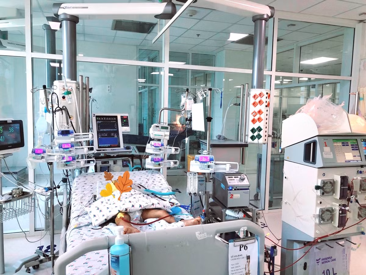 Chay ECMO, loc mau lien tuc cuu song tre 5 tuoi bi ong vo ve chich-Hinh-3