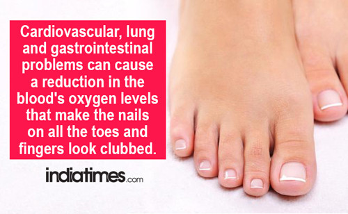 Thay đổi màu sắc móng liên quan đến bệnh phổi. Khi mắc các bệnh tim mạch, phổi hoặc các vấn đề về tiêu hóa dễ gây nên tình trạng thay đổi màu sắc trên móng tay, chân. Điều này xảy ra do tình trạng giảm nồng độ oxy trong máu.