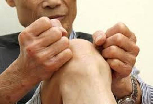 Dù vậy, ngay cả thời điểm bệnh nhân không cảm nhận cơn đau thì viêm khớp dạng thấp vẫn tồn tại. Đôi khi, nó khiến người mắc cảm thấy đau nhức khó chịu hoặc sưng lên ở các khớp.