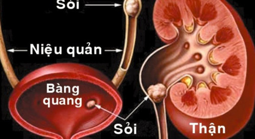 Các cơ quan bên trong vận hành tốt hơn. Ngoài cảm giác tràn đầy năng lượng, uống nước dừa trong vòng 1 tuần còn giúp cơ thể loại bỏ độc tố và sỏi thận hình thành bên trong. Nước dừa đặc biệt tốt cho người bệnh thận bởi nó giúp làm sạch đường tiết niệu, bàng quang một cách dễ dàng.