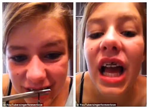 Cô cho biết cách làm này có thể “gây đau nhức, đặc biệt là trong những ngày đầu tiên, nhưng đừng bỏ cuộc, vì kết quả sẽ hoàn toàn xứng đáng với những gì bạn bỏ ra".