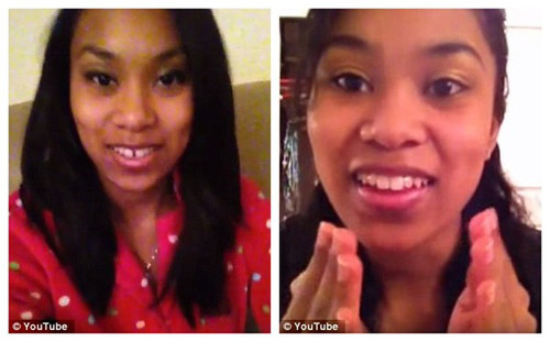 Quá trình niềng răng bằng kim loại không đồng nghĩa với việc bạn chỉ cần mang bộ niềng đủ ngày đủ tháng là có kết quả mỹ mãn. Theo thời gian, các nha sĩ cần tác động điểu chỉnh cẩn thận để kiểm soát sự chuyển động của các răng nhỏ. Bằng cách này, nha sĩ sẽ điều chỉnh răng để chúng phát triển đúng hướng.