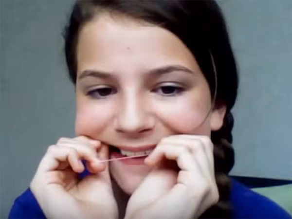 Theo các chuyên gia, mặc dù chi phí niềng răng là khá đắt đỏ song để khắc phục những hậu quả khó lường từ việc niềng răng bằng dây thun sẽ còn tốn gấp nhiều hơn thế.