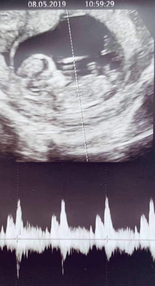 Chong Lan Khue khoe anh sieu am, xac nhan vo dang mang bau