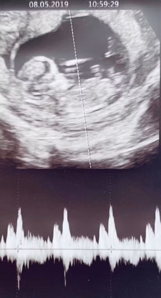 Chong Lan Khue khoe anh sieu am, xac nhan vo dang mang bau