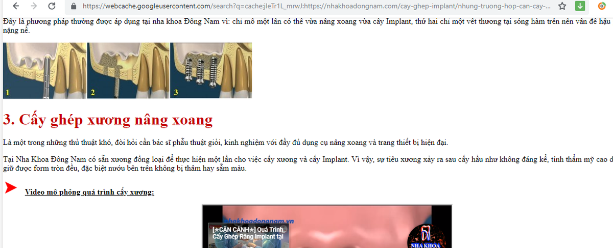 Nha khoa Dong Nam su dung xuong khong ro nguon goc cho phep cho benh nhan-Hinh-2