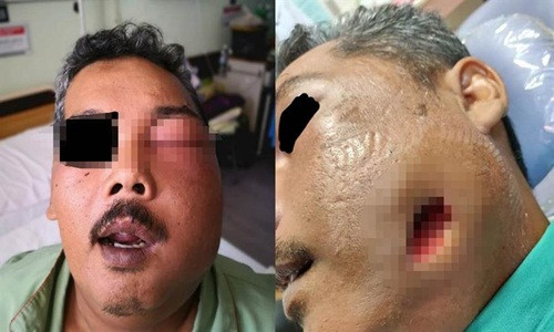 Dau rang boi dau may, nguoi dan ong gap chuyen hai hung