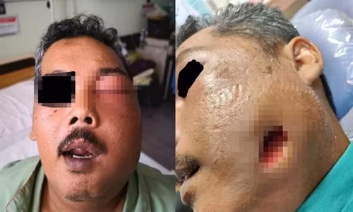 Dau rang boi dau may, nguoi dan ong gap chuyen hai hung