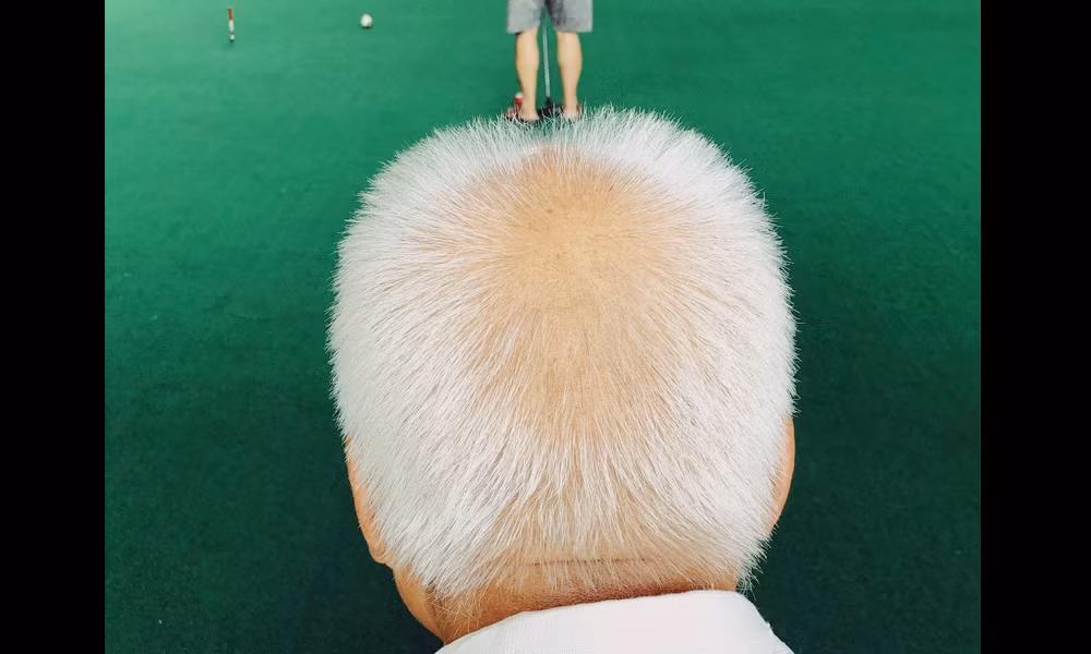 Giải nhất hạng mục con người thuộc về tác giả Wei Xiong.