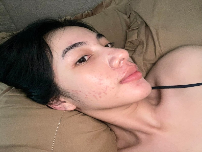 Dù trang điểm dày, chụp ảnh dùng ứng dụng làm đẹp cũng không thể khiến Cẩm Đan che được mụn. Ảnh: FBNV