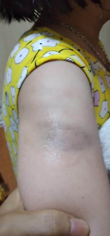 Phu huynh len mang to giao vien danh hoc sinh bam tay vi viet bai cham