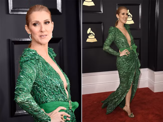 Từ trước tới nay, Celine Dion vốn già hơn so với tuổi, nhưng trong lễ trao giải Grammy 2017 khuôn mặt cô thực sự trông già nua hơn rất nhiều so với tuổi.