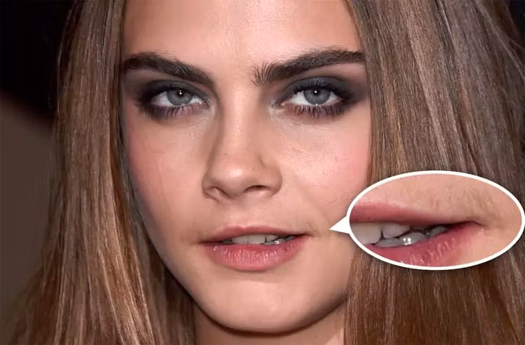 Nổi tiếng với cặp lông mày rậm, người mẫu Cara Delevingne còn có cả ria mép khá đậm. Cô là một trong những sao nữ Hollywood lười waxing và bị soi tới bến. (Ảnh: nydailynews)