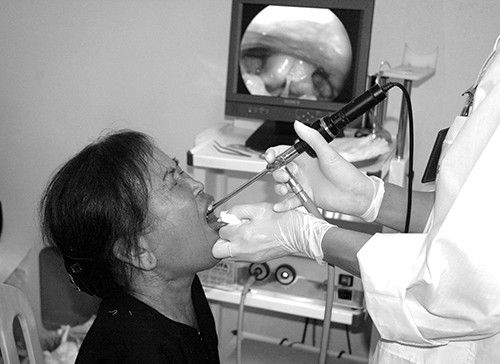 Dau hieu nhan biet ung thu amidan thuong thay