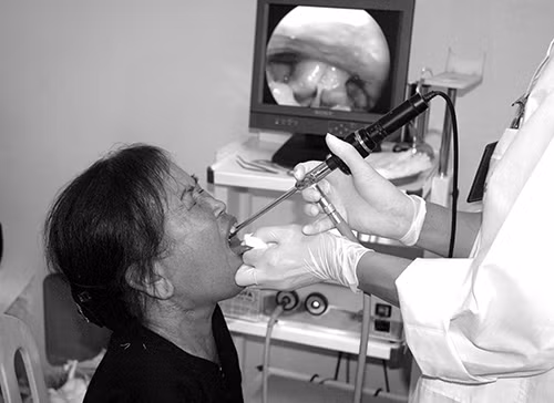 Dau hieu nhan biet ung thu amidan thuong thay