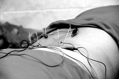 Phụ nũ co thai tuyẹt dói cám di cham cuu