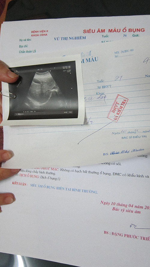 Kinh nghiem day lui ung thu buong trung cua mot phu nu Ha Noi-Hinh-2