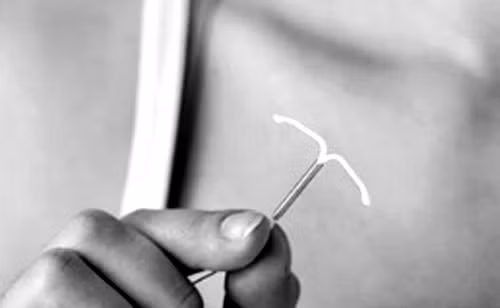 Thoi diem tot nhat de thao vong tranh thai