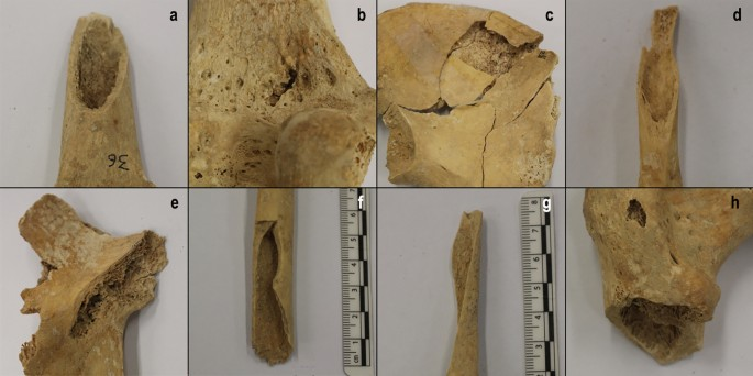 Các nhà khảo cổ đã phát hiện tổng cộng 107 vết thương trên các bộ xương, chủ yếu là ở sọ, nhiều hơn ở nam giới so với nữ giới.