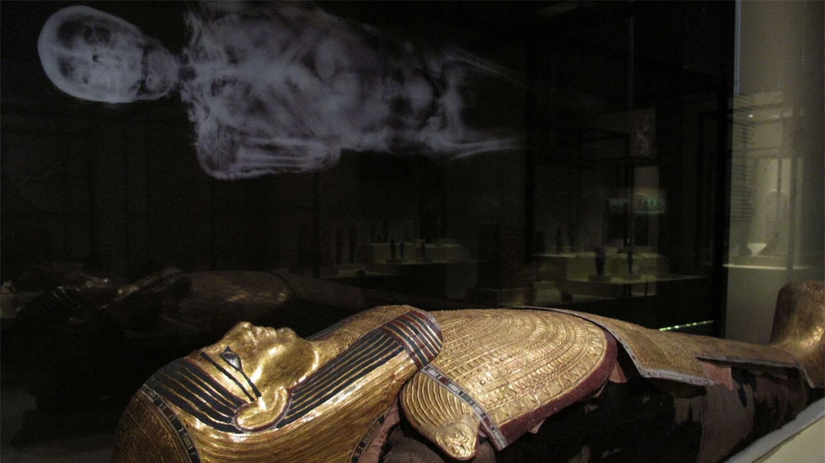 Nhà nghiên cứu giải thích rằng em bé được sinh ra trong tư thế ngôi ngược (chân ra trước), trong quá trình sinh nở, đầu em bé bị kẹt lại trong ống sinh.