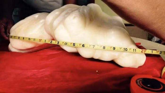 Viên ngọc trai Puerto Princesca hiện được trưng bày tại Tòa thị chính New Green ở Puerto Princesa, Philippines, và trở thành điểm du lịch nổi tiếng.