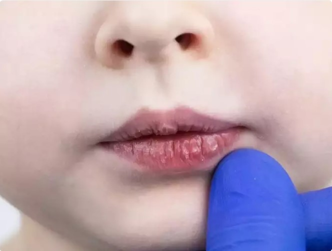 Nhung thuc pham co san trong bep giup chua lanh doi moi nut ne-Hinh-6