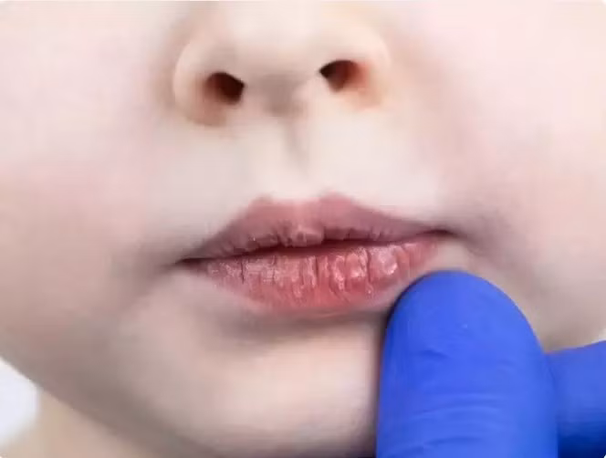 Nhung thuc pham co san trong bep giup chua lanh doi moi nut ne-Hinh-6