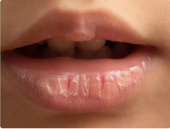 Nhung thuc pham co san trong bep giup chua lanh doi moi nut ne