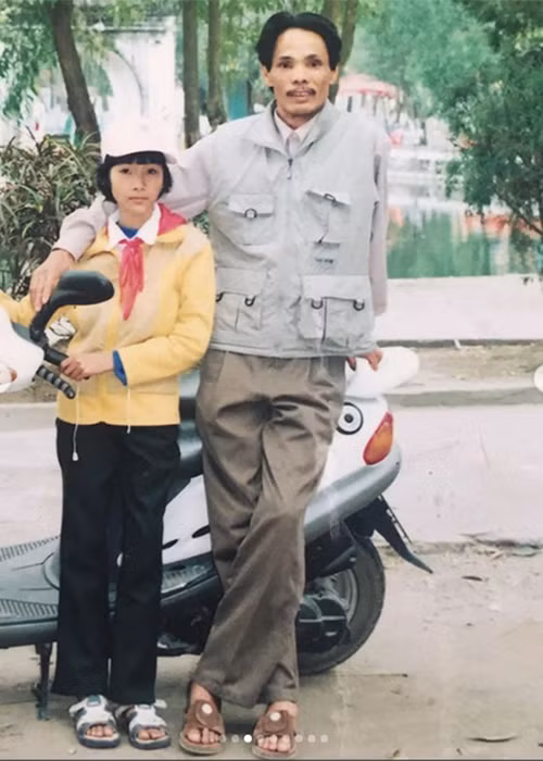 Khi nhỏ, top 20 Hoa hậu Hoàn vũ Thế giới 2019 có chiều cao vượt trội nhưng vóc dáng gầy gò.