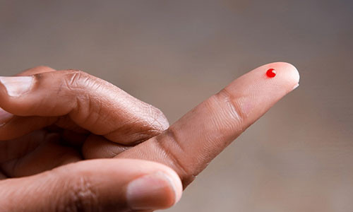 Cat doi que thu HIV o Xanh Pon: Lay truyen 