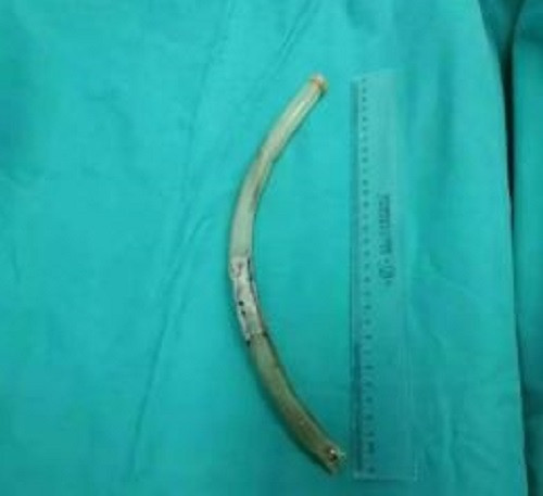 Co gai hoc meo giam can tren mang, gap cai ket nho doi-Hinh-2