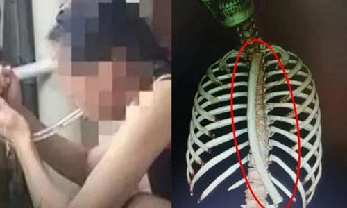 Co gai hoc meo giam can tren mang, gap cai ket nho doi