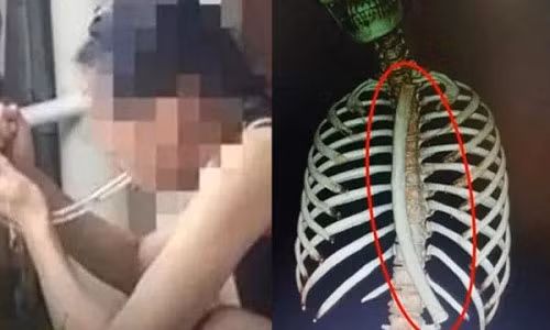 Co gai hoc meo giam can tren mang, gap cai ket nho doi