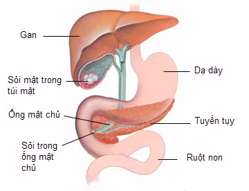 Đang bị khối u. Khi có các khối u trong tuyến tiêu hóa cũng chống chỉ định với dùng gừng, bởi gừng sẽ kích thích sự tiến triển những khối u này.