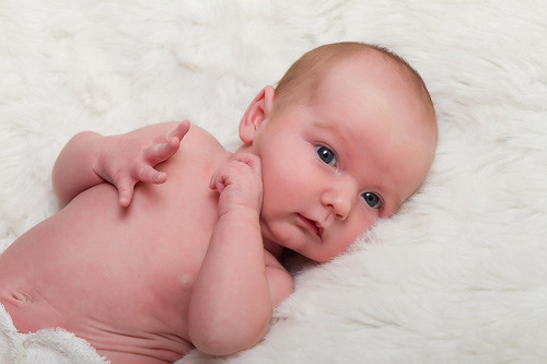 Da bé trở nên nhăn nheo và vàng. Dấu hiệu này có thể cho thấy bé đang thiếu chất dinh dưỡng, do đó, mẹ phải lưu ý hơn khi cho con bú.