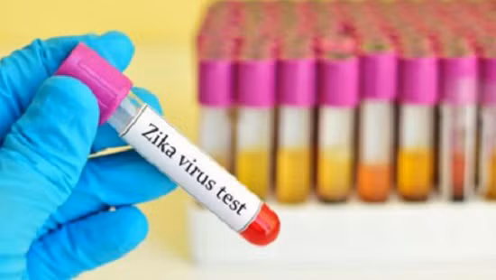 Sau đó, mẫu bệnh phẩm được chuyển về phòng xét nghiệm có năng lực xét nghiệm virus Zika trong thời gian nhanh nhất. Từ khi tiếp nhận mẫu bệnh phẩm đến khi có kết quả là khoảng 24h.