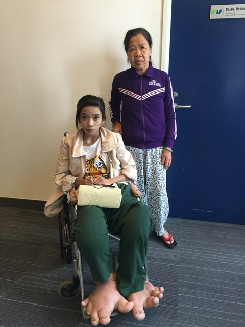 Noi kho cua thieu nu Hue mang doi chan khong lo