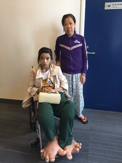 Noi kho cua thieu nu Hue mang doi chan khong lo