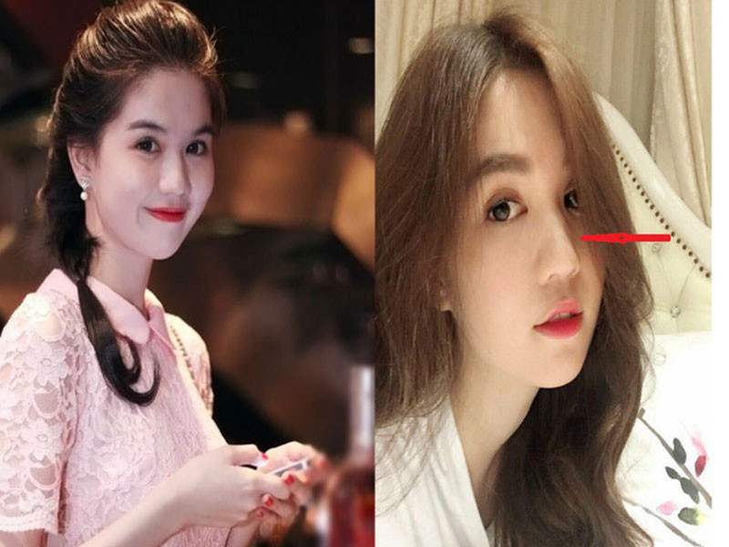 Không quá khó để nhận ra sự thay đổi mí mắt, cằm của Ngọc Trinh so với trước đây. Ảnh: Tri thức trẻ