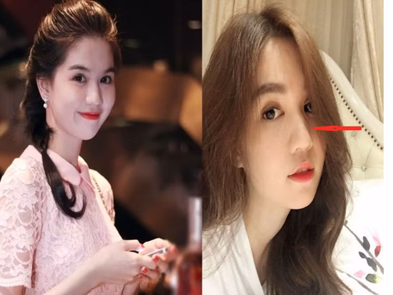 Không quá khó để nhận ra sự thay đổi mí mắt, cằm của Ngọc Trinh so với trước đây. Ảnh: Tri thức trẻ