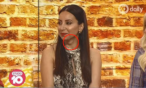 Nguoi xem phat hien “tu than” bam tren co, nu MC duoc cuu mang than ky