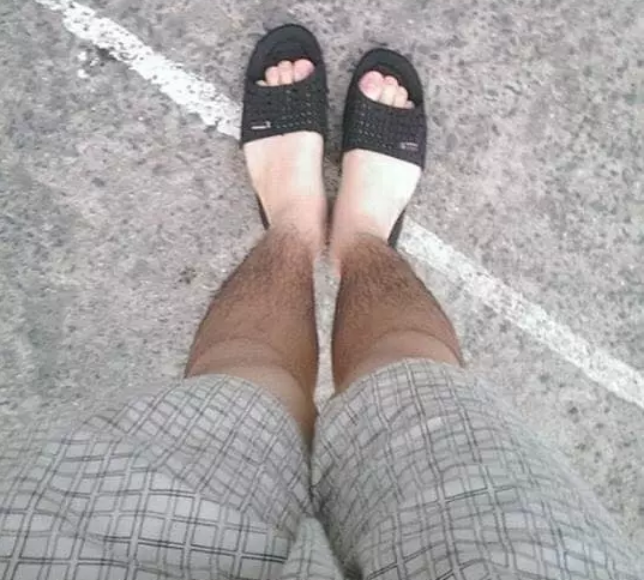 Làn da bỗng chốc chia thành hai mảng màu đen - trắng chỉ vì không mặc quần dài.