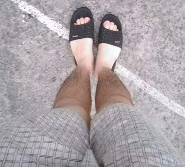 Làn da bỗng chốc chia thành hai mảng màu đen - trắng chỉ vì không mặc quần dài.